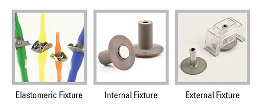 What are fixtures?